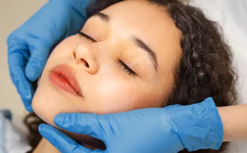 Armonización Orofacial 3D