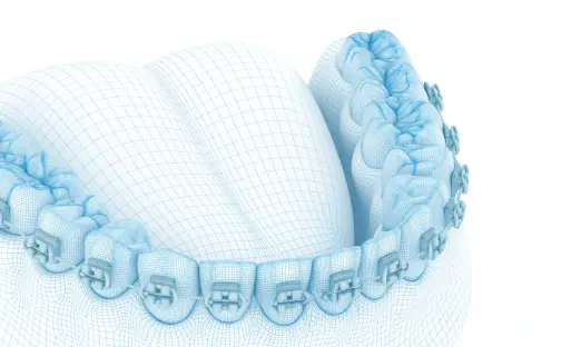 Ortodoncia Funcional Digital